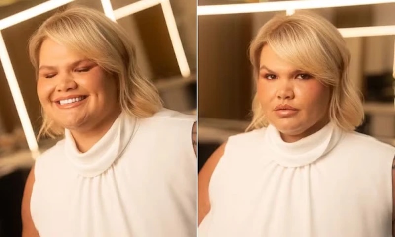 Thais Carla choca a web ao revelar peso atual após bariátrica;  - Thais Carla revela perda de 74 kg após cirurgia bariátrica