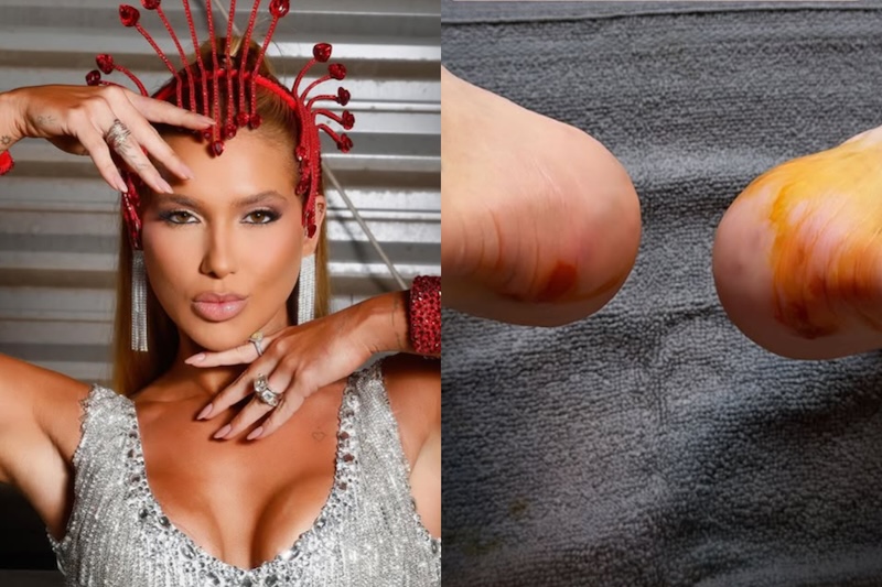 Virginia mostra preparação para o Carnaval e pés machucados.  - Virginia Fonseca intensifica preparação para o Carnaval 2026 como Rainha de Bateria